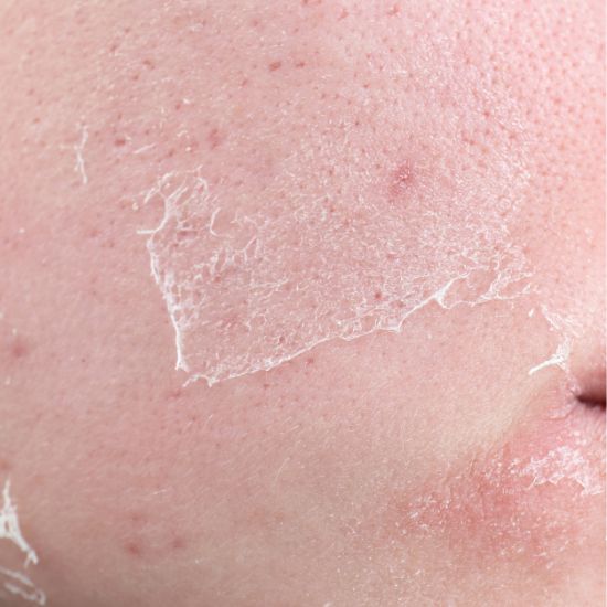 Anti-Inflammatory