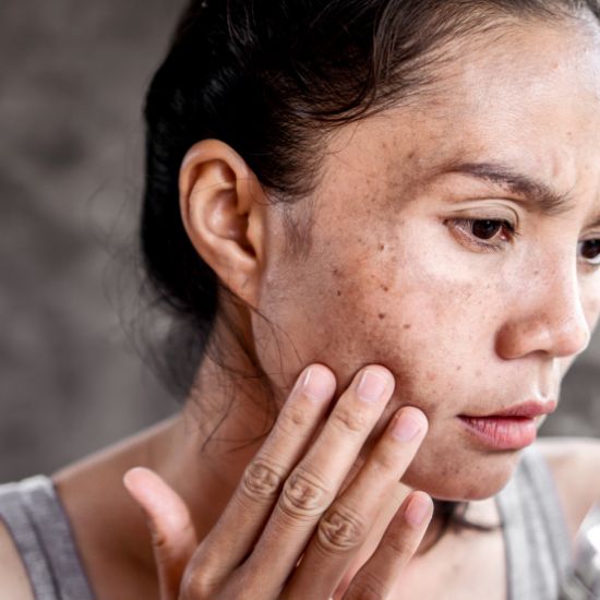 Dark Spot Care