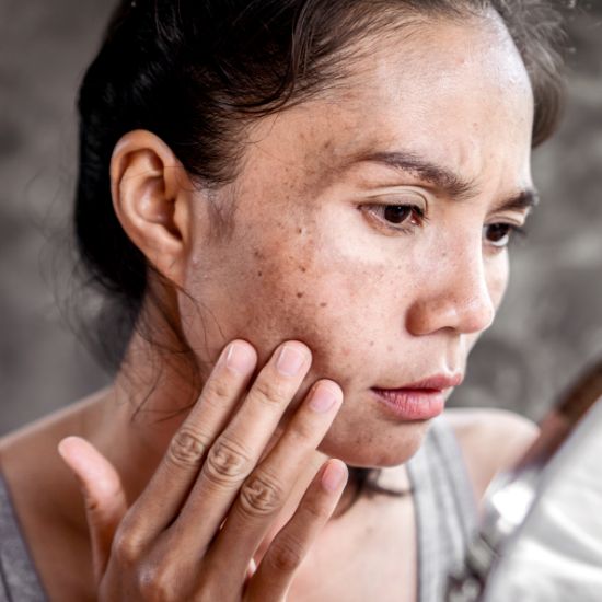 Dark Spot Correcting and Skin Tone Improving