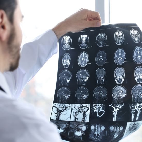 Neuroprotection Support