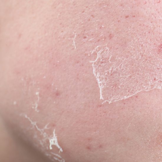 Skin Barrier Repair and Anti-aging